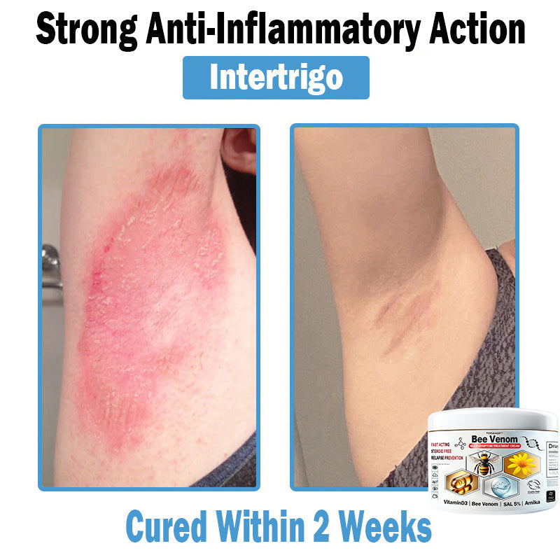 TOD𝐀HOF™🏅 Krem wielozadaniowy na bazie jadu pszczelego (👨‍⚕ZALECA NPF)