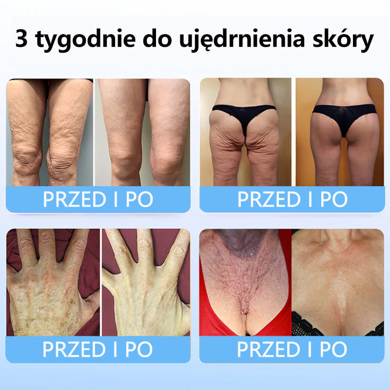 TLOPA™ Kolagen Peptydy UJĘDRNIAJĄCE SERUM W SZTYFCIE🎄🎄🎄  – Państwowy Zakład Higieny (PZH) oraz Polskie Towarzystwo Dermatologiczne (PTD), gwarantujące najwyższą jakość i bezpieczeństwo dla Twojej skóry.