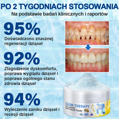 🥇Oficjalny sklep Furzero™ Focussmile Bee Venom Treatment Oral Powder 🦷 (zalecany przez ADA)