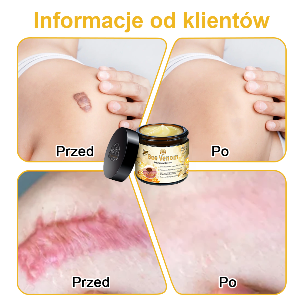 【🫧Płatność przy odbiorze🫧】Turonu™ leczniczy krem do skóry z jadem pszczelim (zalecany przez AAD)