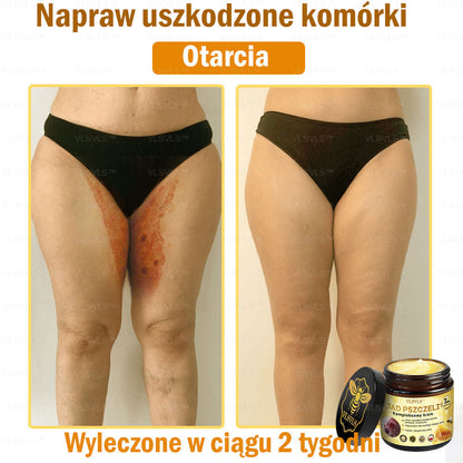 VLSVLS™ Krem Komprehensywny z Jadami Pszczół 🇺🇸 Rekomendowany przez Dermatologów