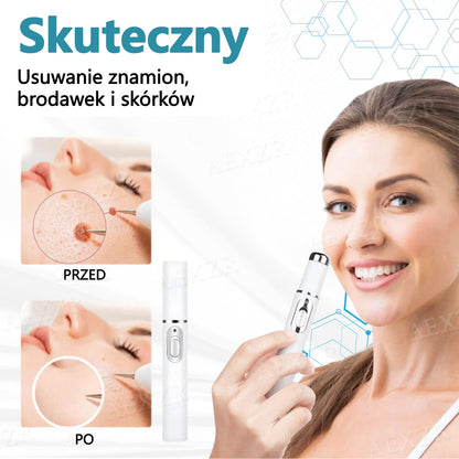 Bikenda® Nieinwazyjny Laserowy Długopis do Usuwania Pieprzyków i Brodawek