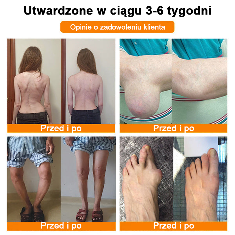 ✅Oficjalny sklep: Ouryard™ Olej magnezowy i miód w sprayu do naprawy stawów👨‍⚕️Zatwierdzony przez Polską Agencję Leków, Wyrobów Medycznych i Produktów Biologicznych (URPL)🔥🔥