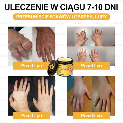 XRLXRL™ Krem Łagodzący Ból i Leczenie Kości z Jadłem Pszczelim (Specjalnie dla starszych dorosłych i polecany przez AAOS)