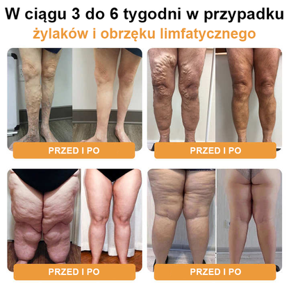 🔥JOSFIT™ Ultradźwiękowy detoks tłuszczowy i daleką podczerwień równoważąca poziom cukru we krwi opaska na nadgarstek - Energy Balance Specjalna oferta ograniczona czasowo