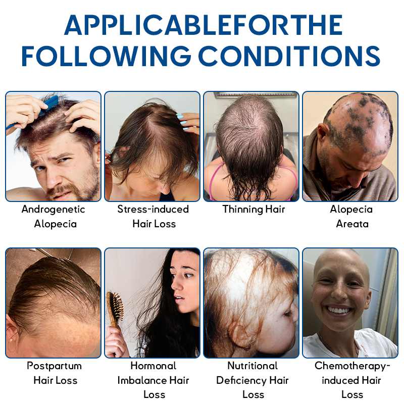 🦘𝐎𝐟𝐟𝐢𝐜𝐢𝐚𝐥 𝐒𝐭𝐨𝐫𝐞 | Flysmus® STEM Cell Hair Cycle Roller - See results in 7 days (🔥UP TO 70% OFF)