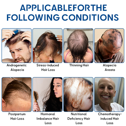 🦘𝐎𝐟𝐟𝐢𝐜𝐢𝐚𝐥 𝐒𝐭𝐨𝐫𝐞 | Flysmus® STEM Cell Hair Cycle Roller - See results in 7 days (🔥UP TO 70% OFF)