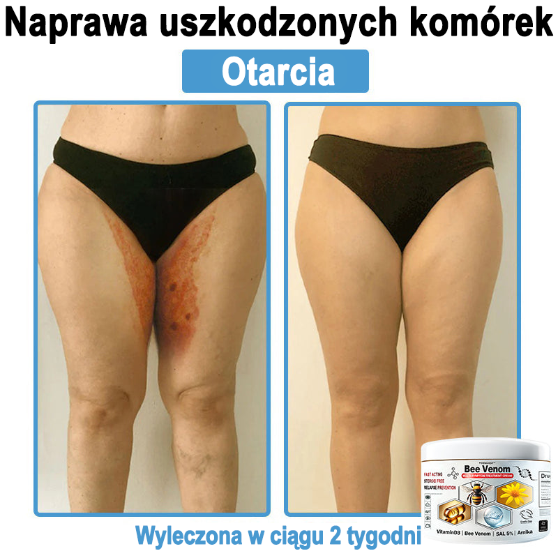 TOD𝐀HOF™🥑 Krem do wielosymptomowej pielęgnacji skóry z jadem pszczelim (ACDRECOMMENDS)