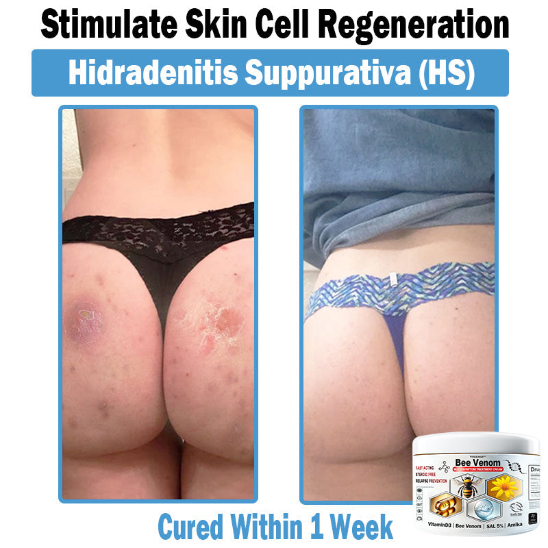 TOD𝐀HOF™🏅 Krem wielozadaniowy na bazie jadu pszczelego (👨‍⚕ZALECA NPF)