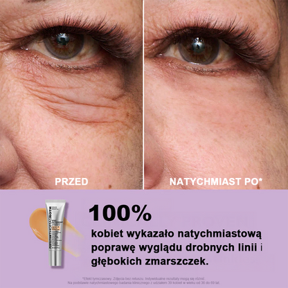 🌸Natychmiastowy Liftingujący Krem pod Oczy o Lekkiej Konsystencji – Maksymalne Ujędrnienie i Gładkie Wykończenie ✨