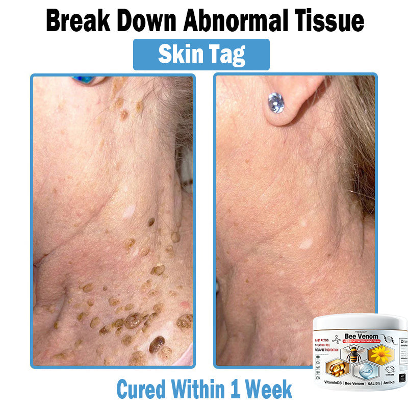 TOD𝐀HOF™🏅 Krem wielozadaniowy na bazie jadu pszczelego (👨‍⚕ZALECA NPF)