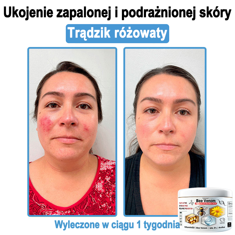 TOD𝐀HOF™🥑 Krem do wielosymptomowej pielęgnacji skóry z jadem pszczelim (ACDRECOMMENDS)