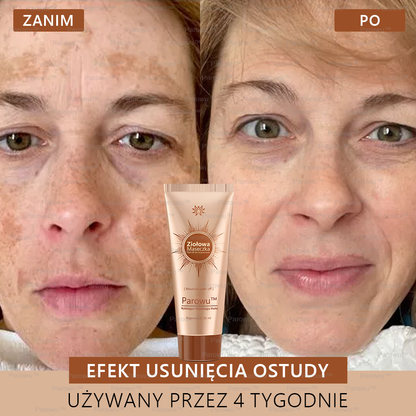 Parowu™ Wybielająca i Rozjaśniająca Maska - Naturalne składniki trwale usuwają plamy, piegi i przebarwienia