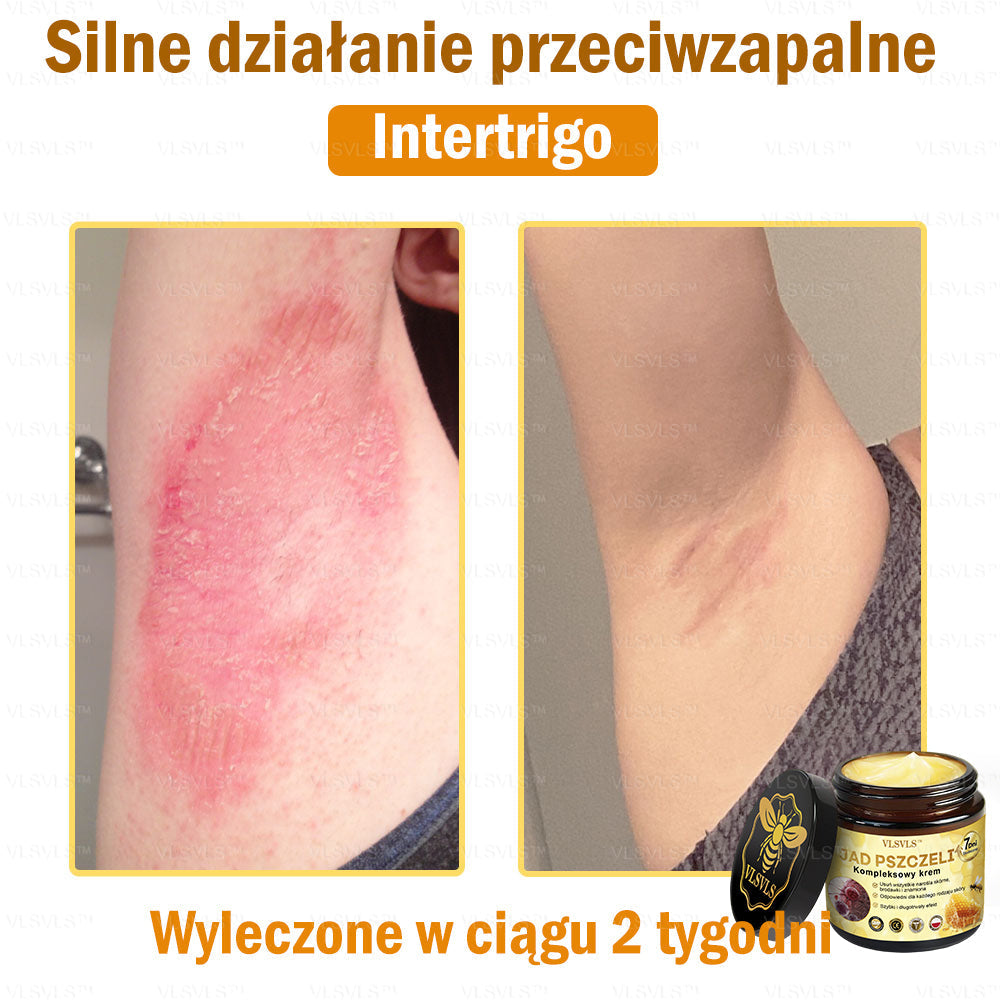 VLSVLS™ Krem Komprehensywny z Jadami Pszczół 🇺🇸 Rekomendowany przez Dermatologów