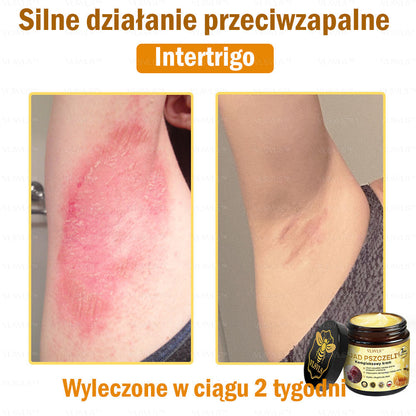 VLSVLS™ Krem Komprehensywny z Jadami Pszczół 🇺🇸 Rekomendowany przez Dermatologów