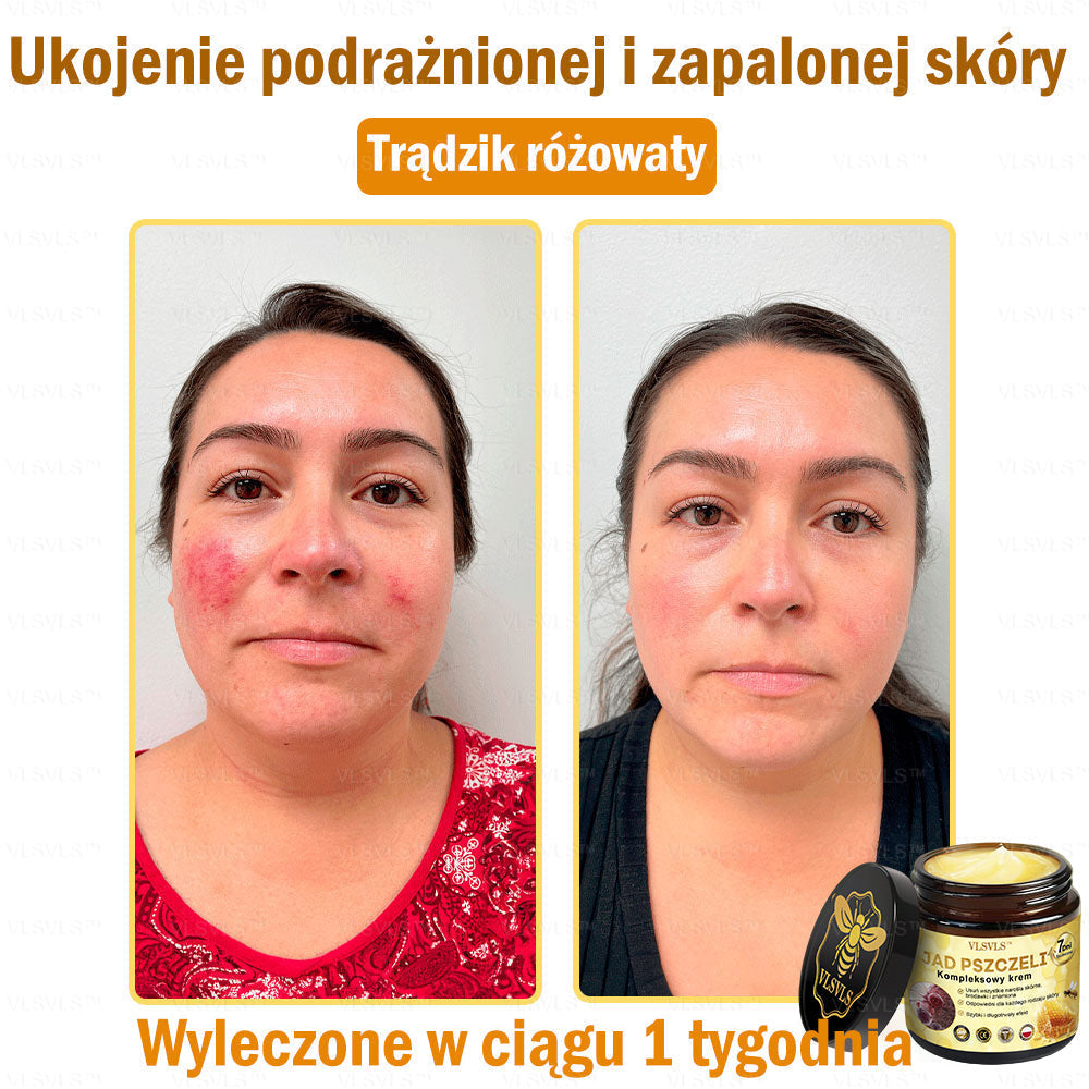 VLSVLS™ Krem Komprehensywny z Jadami Pszczół 🇺🇸 Rekomendowany przez Dermatologów