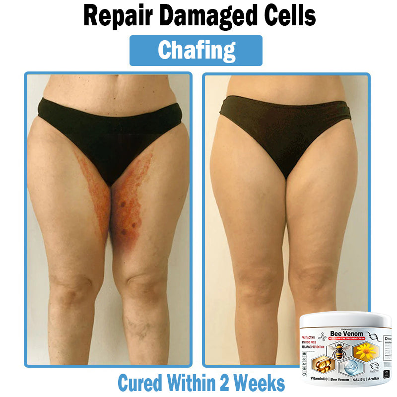 TOD𝐀HOF™🏅 Krem wielozadaniowy na bazie jadu pszczelego (👨‍⚕ZALECA NPF)