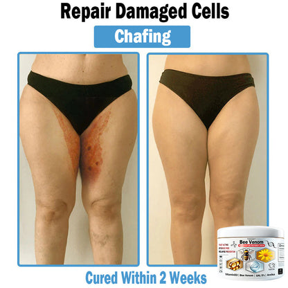 TOD𝐀HOF™🏅 Krem wielozadaniowy na bazie jadu pszczelego (👨‍⚕ZALECA NPF)