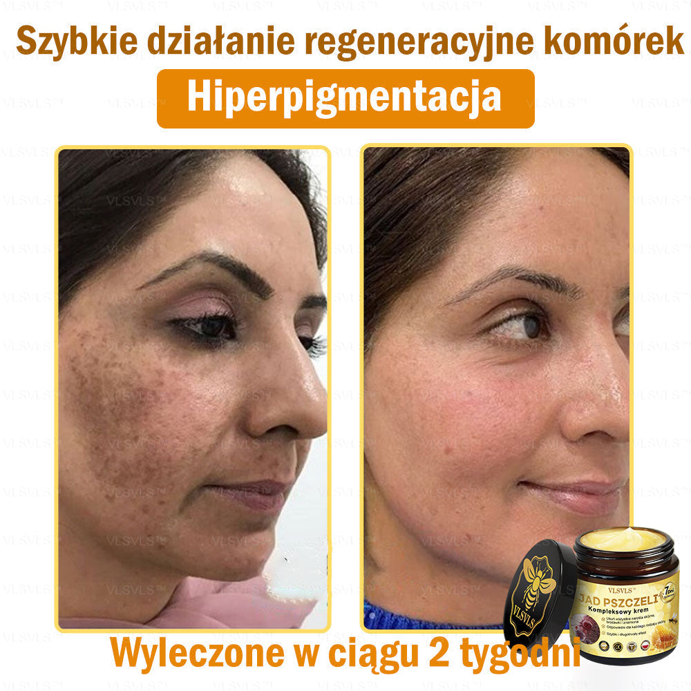 VLSVLS™ Krem Komprehensywny z Jadami Pszczół 🇺🇸 Rekomendowany przez Dermatologów
