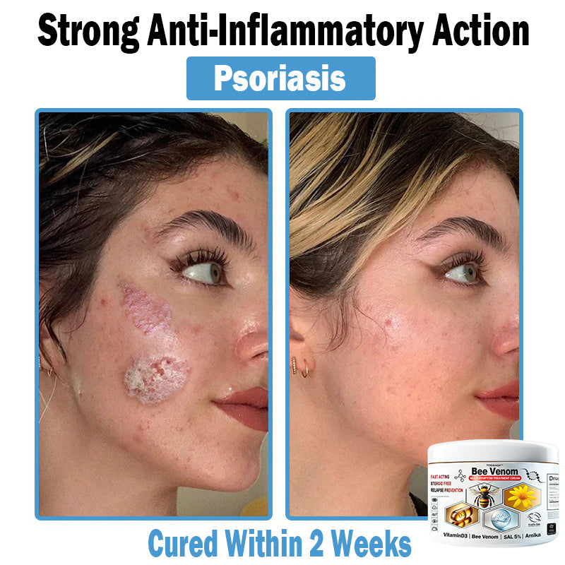 TOD𝐀HOF™🏅 Krem wielozadaniowy na bazie jadu pszczelego (👨‍⚕ZALECA NPF)