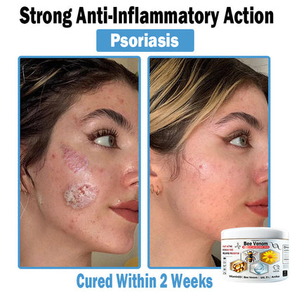 TOD𝐀HOF™🏅 Krem wielozadaniowy na bazie jadu pszczelego (👨‍⚕ZALECA NPF)