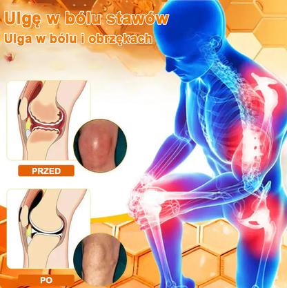 ✅Oficjalny sklep: Ouryard™ Olej magnezowy i miód w sprayu do naprawy stawów👨‍⚕️Zatwierdzony przez Polską Agencję Leków, Wyrobów Medycznych i Produktów Biologicznych (URPL)🔥🔥